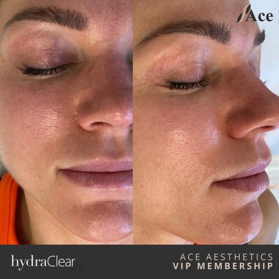 Ace Aesthetics - Ace Aesthetics